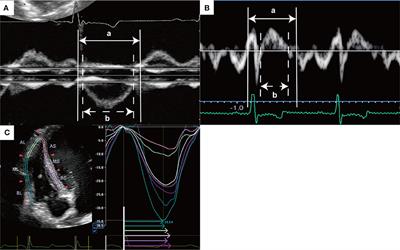 Evaluation of Right Ventricular Function and Dyssynchrony in a Dog Model of Acute Pulmonary Embolism: Diagnostic Utility and Reversibility